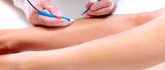 Electric hair removal