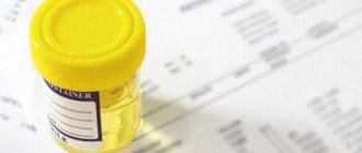 urine in a container for analysis
