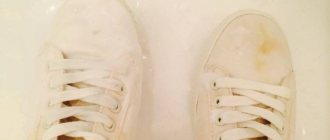 Causes of yellowing white shoes