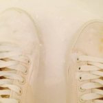 Причины пожелтения белой обуви